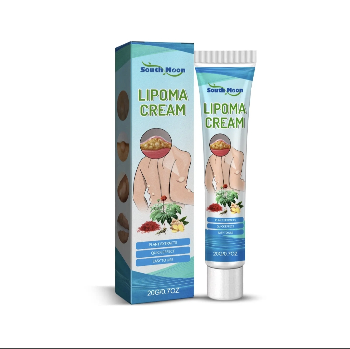 Lipoma Romoval Cream 01 pcs
